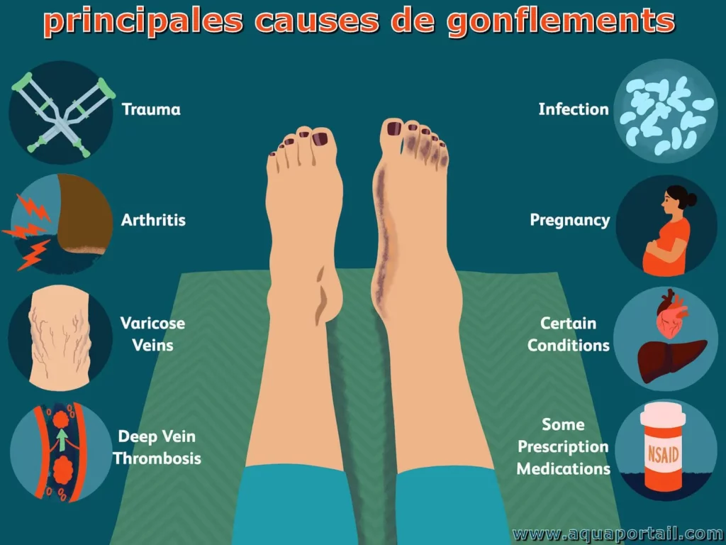 vide de rate symptômes : rétention d'eau3 avec labyrinthe-kinésiologie et guy-arnaud Pénet